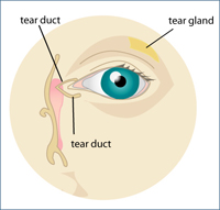 Dry Eyes Diagram